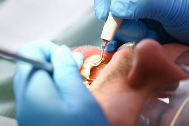 Best After-Hours Emergency Dentist in Latimer, MS